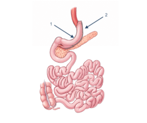 Bariatric Surgeon in Islamabad