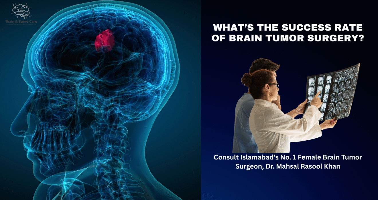 Brain tumor surgeon in islamabd