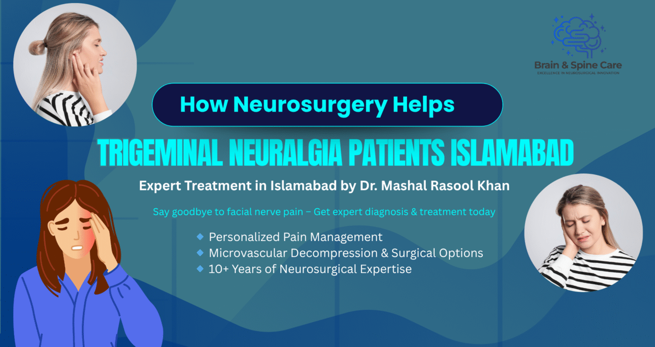 Trigeminal Neuralgia Treatments by Dr. Mashal in Islamabad